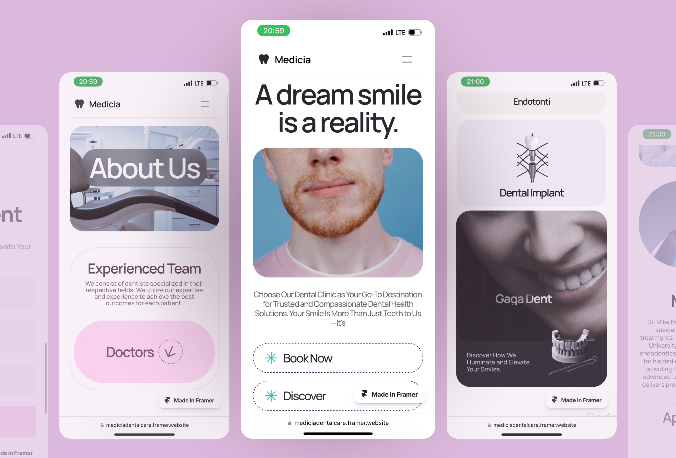 医疗健康网站设计灵感，医疗健康、SaaS Framer 网站模板详情图 2
